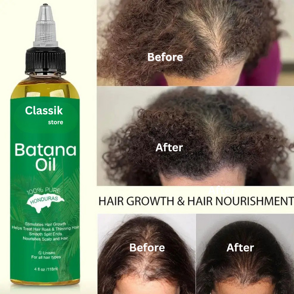 Classik Batana Bloom